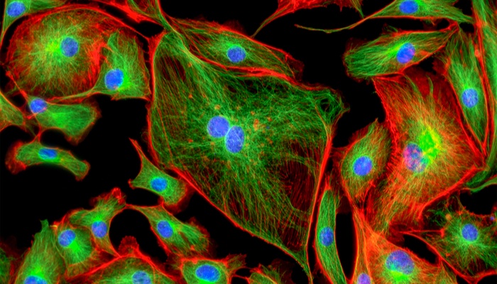 Fluorescence microscopy